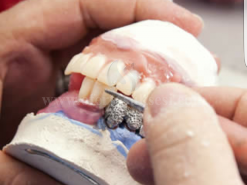 Kerkoj pune - Teknik i dhëmbeve (stomatologjik)